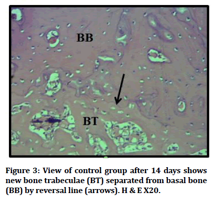 medical-dental-basal