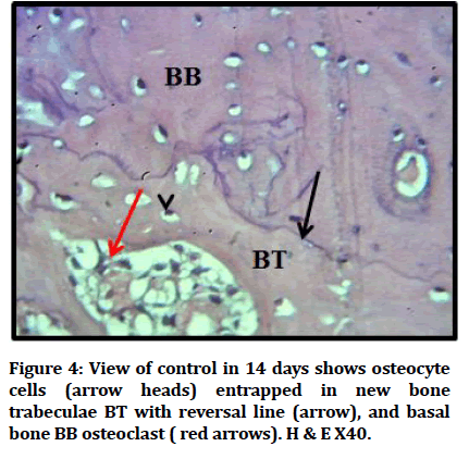 medical-dental-osteocyte