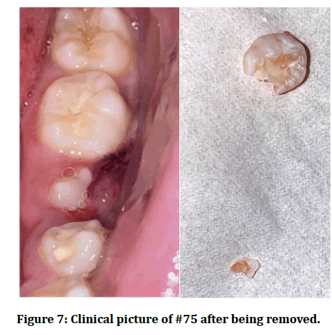 medical-dental-removed