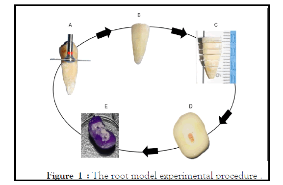 odontology-root