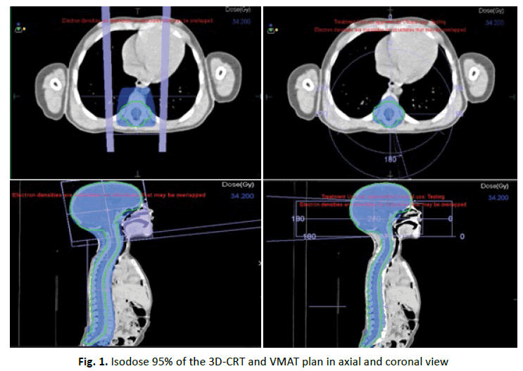 oncologyradiotherapy-Isodose