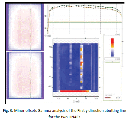 oncologyradiotherapy-LINACs