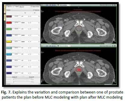 oncologyradiotherapy-MLC