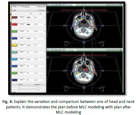 oncologyradiotherapy-MLC-modeling