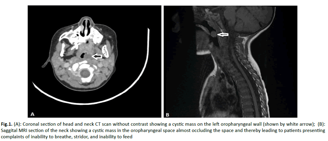 oncologyradiotherapy-Saggital