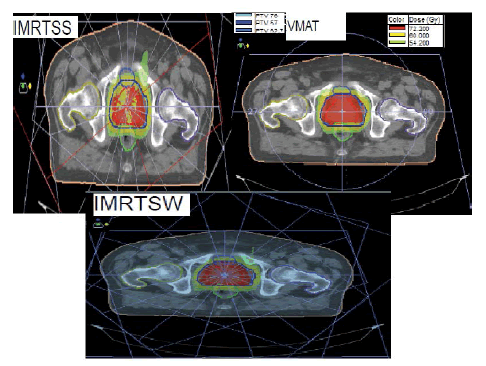 oncologyradiotherapy-ballistics