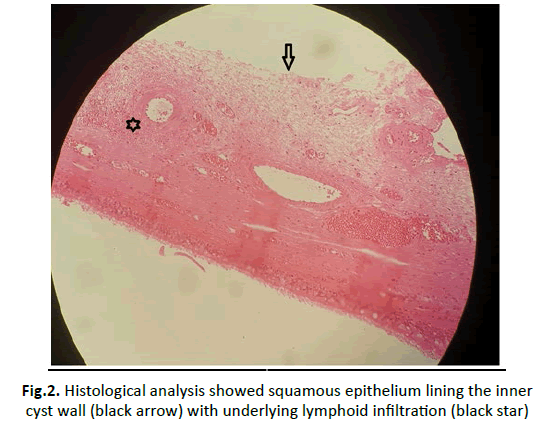 oncologyradiotherapy-epithelium