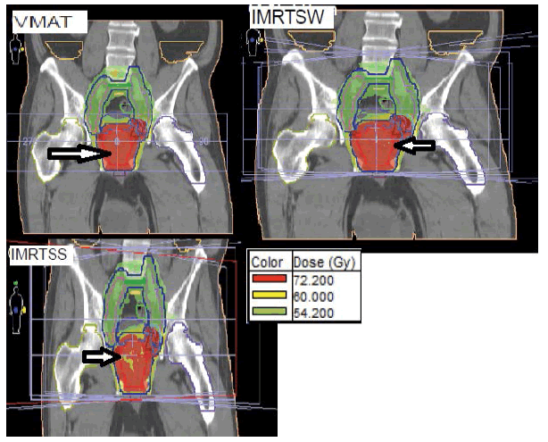 oncologyradiotherapy-sagittal