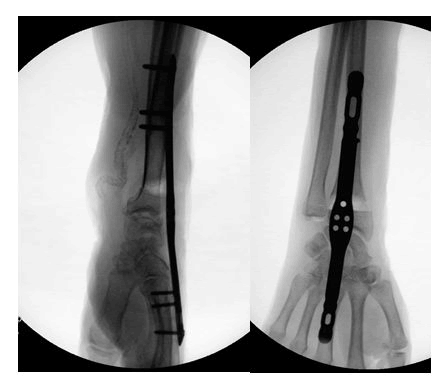 orthopedic-muscular-system