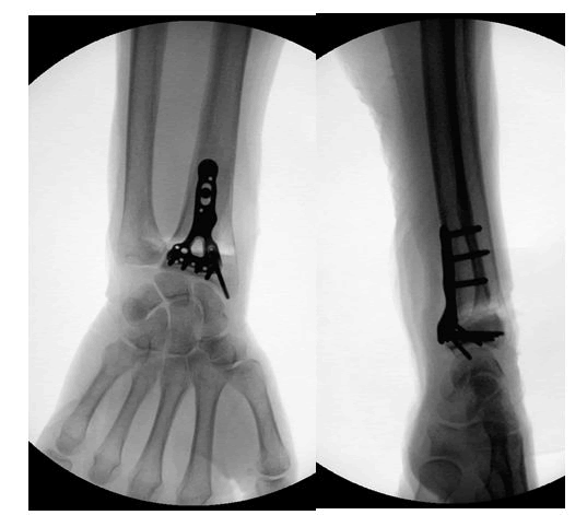 orthopedic-muscular-system