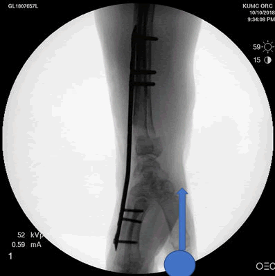 orthopedic-muscular-system