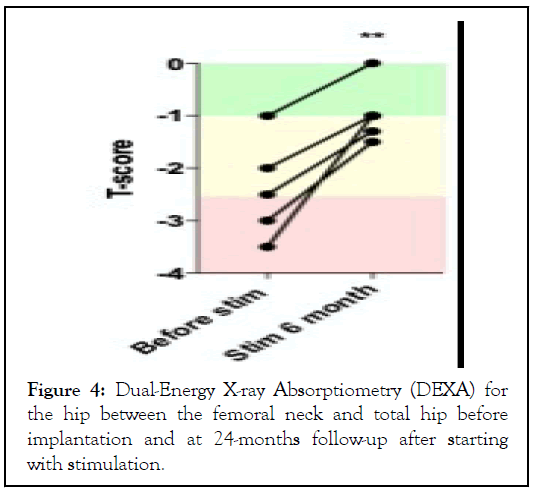 Absorptiometry