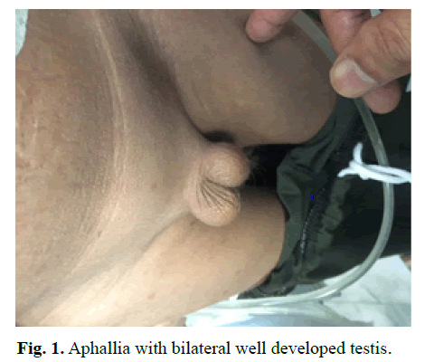 pediatric-urology-bilateral