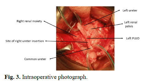 pediatric-urology-intraoperative