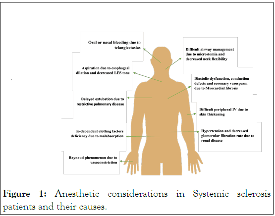 rhuematology-anesthetic