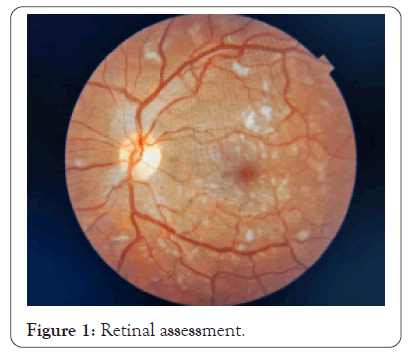 rhuematology-retinal
