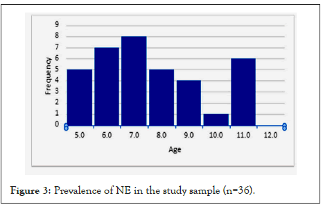 sleep-disorders-prevalence