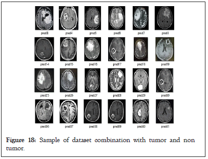 tumor-dataset