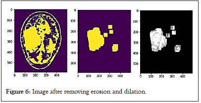 tumor-erosion