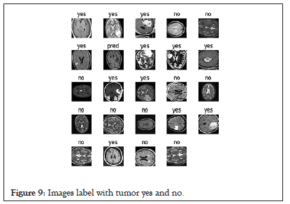 tumor-label