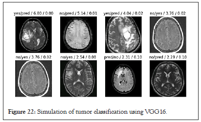 tumor-vgg16