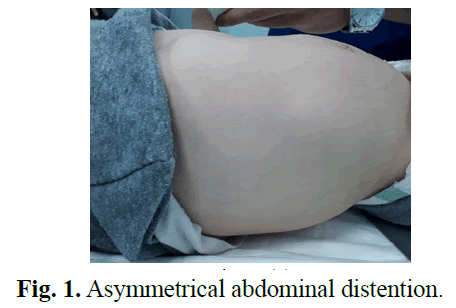 urology-abdominal