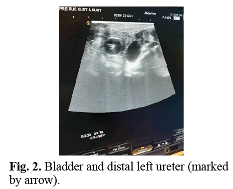 urology-bladder