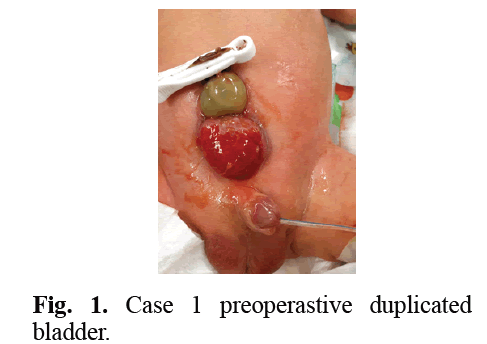 urology-case1