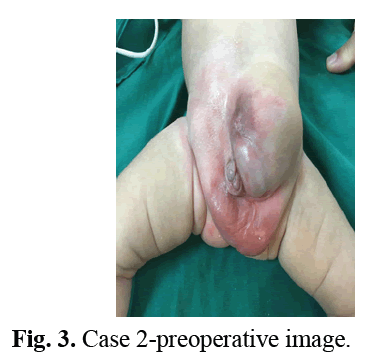 urology-case2