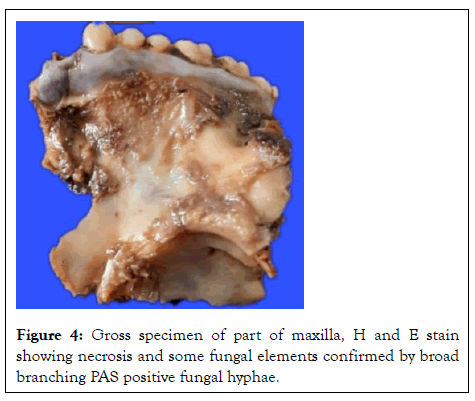 virology-mycology-specimen