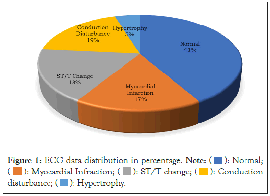 ECG