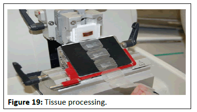 Cancer-Research-Tissue