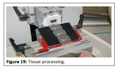 Cancer-Research-Tissue