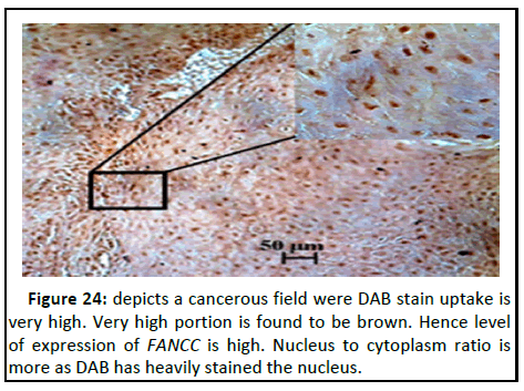 Cancer-Research-cytoplasm