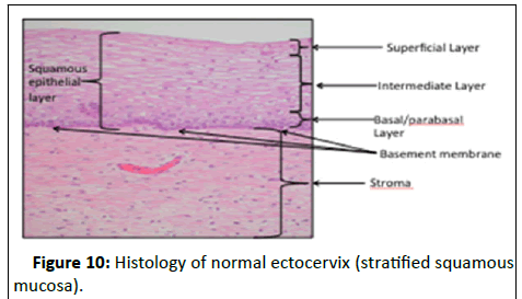 Cancer-Research-ectocervix