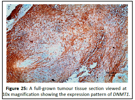 Cancer-Research-magnification