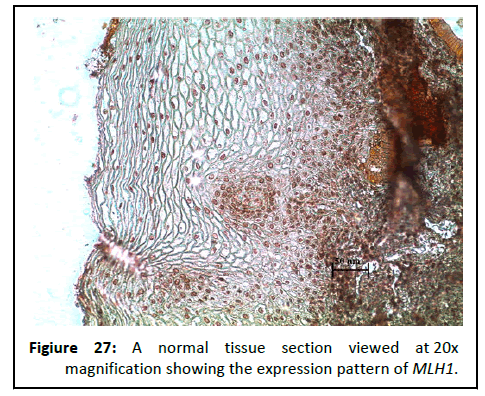 Cancer-Research-pattern