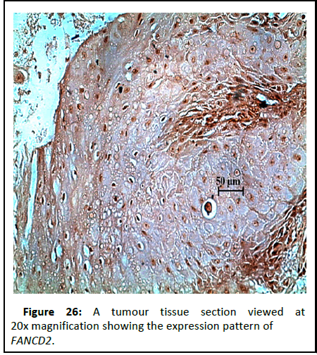 Cancer-Research-section