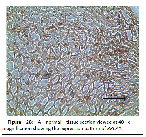 Cancer-Research-section