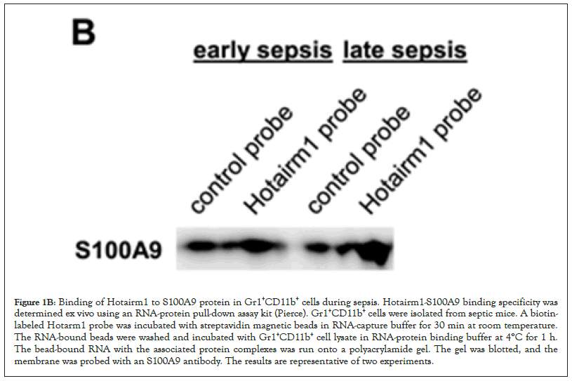 sepsis