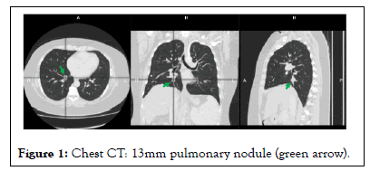 pulmonary