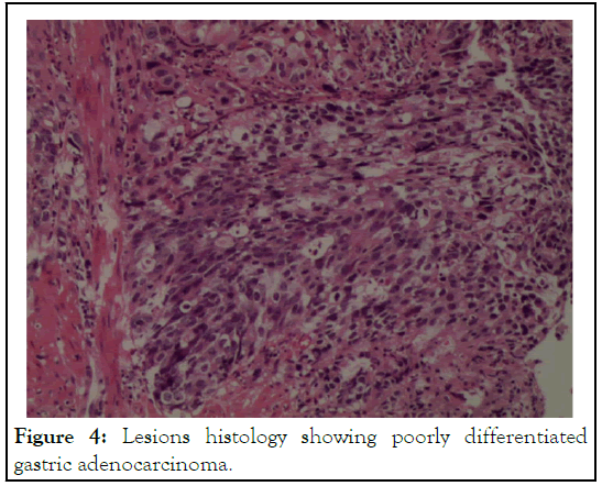 Clinical-Lesions