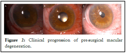 Clinical-Ophthalmology