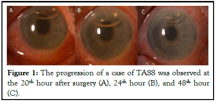 Clinical-Ophthalmology