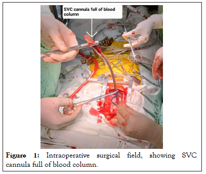 Intraoperative