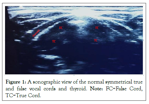 sonographic