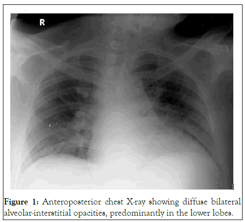 Clinical-Trials-Anteroposterior