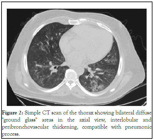 Clinical-Trials-thorax