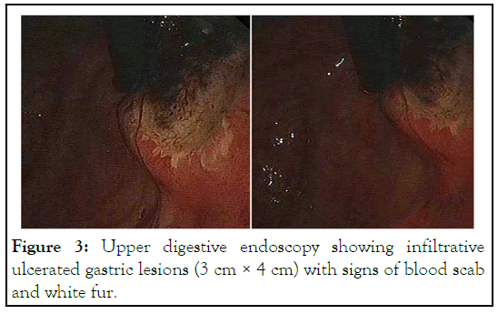 Clinical-endoscopy