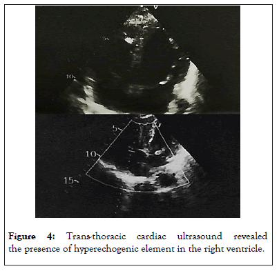 ultrasound